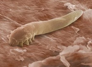 demodex mite