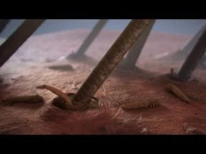 how to get rid of demodex mites