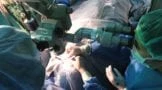 corneal transplant