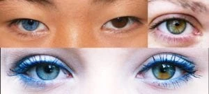 heterochromia