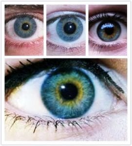 Featured image of post Robert Downey Jr Heterochromia Iridis Heterochromia is a variation in coloration